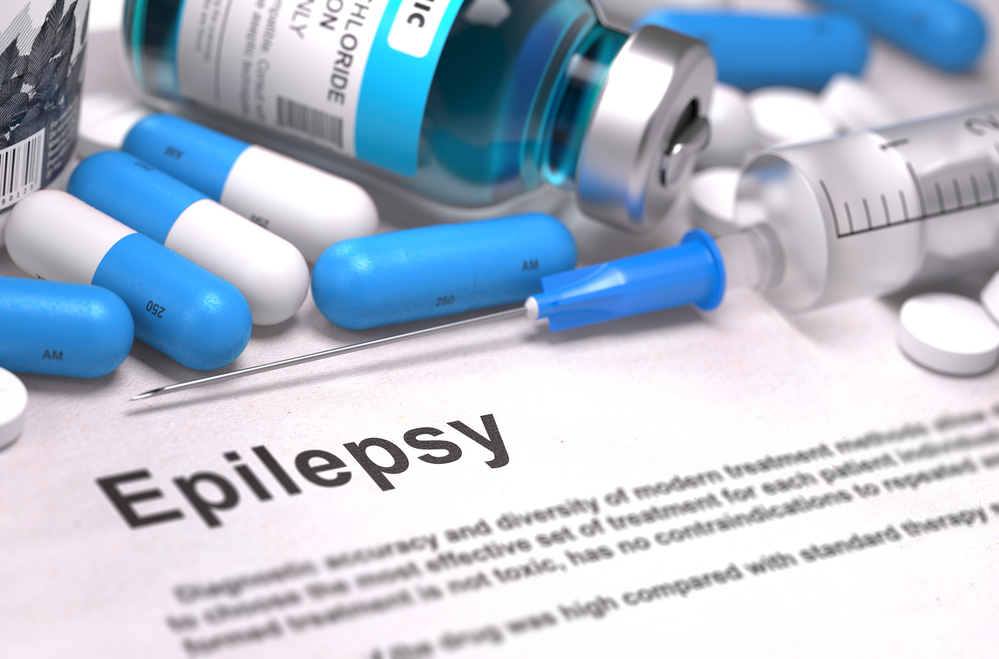 Симптомы эпилепсии