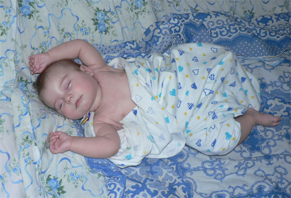 Без задних ног