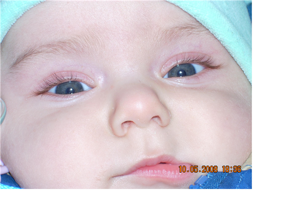 Я так хорошо пригрелся на солнышке!